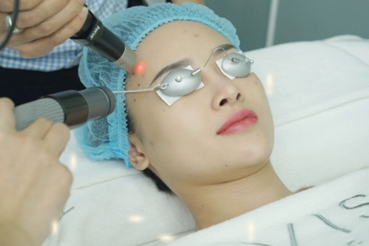 Bắn laser trị sẹo lõm: Những ưu điểm và hạn chế