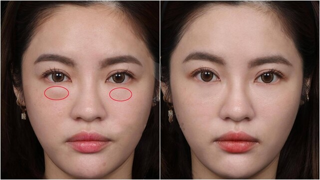 4 Dấu hiệu cho thấy bạn đang lão hoá nhanh hơn tuổi