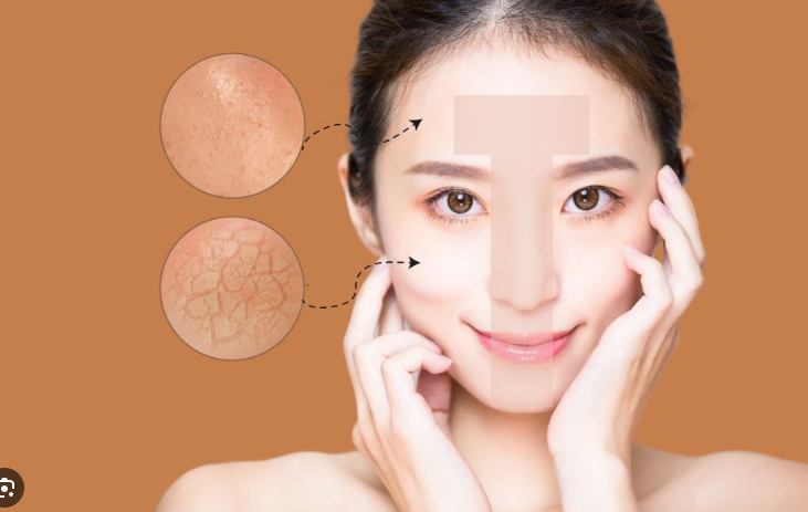 Hướng dẫn cách dưỡng ẩm cho từng loại da