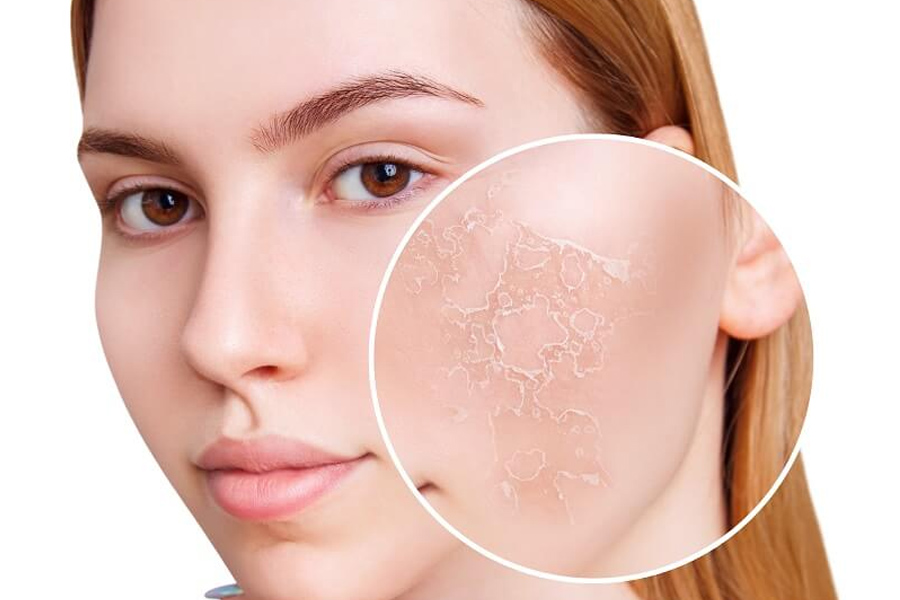 Da khô không ăn phấn: Cách khắc phục hiệu quả 100%