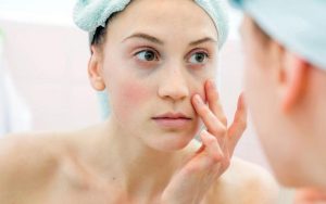 Chăm Sóc Da Khi Bị Kích Ứng: Dấu Hiệu, Nguyên Nhân và Cách Chăm Sóc