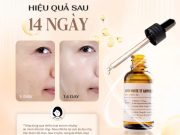 Từ Hàn Quốc đến Việt Nam: Bí mật làm đẹp chuẩn xứ Kim Chi gói gọn trong 1 lọ serum