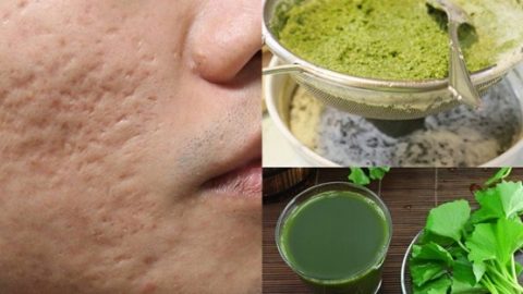 Cách làm mặt nạ rau má sữa chua lấy lại làn da mịn màng tuổi 20.