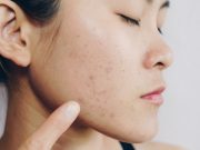 Làn da của bạn sẽ ra sao khi đi ngủ không tẩy trang?